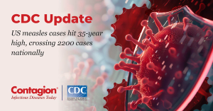 US Measles Cases Set 35-Year Record With 5 months Left in 2026