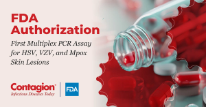 FDA Authorizes First Multiplex PCR Assay for HSV, VZV, and Mpox Skin Lesions