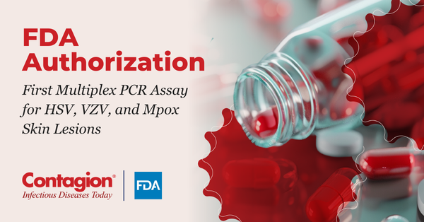 FDA Authorizes First Multiplex PCR Assay for HSV, VZV, and Mpox Skin Lesions