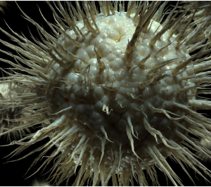 A Case of Hemophagocytic Lymphohistiocytosis Secondary to Cytomegalovirus Infection