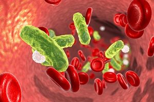 Addressing Shortcomings in Infection and Sepsis Treatment Should Be Top of the Priority List