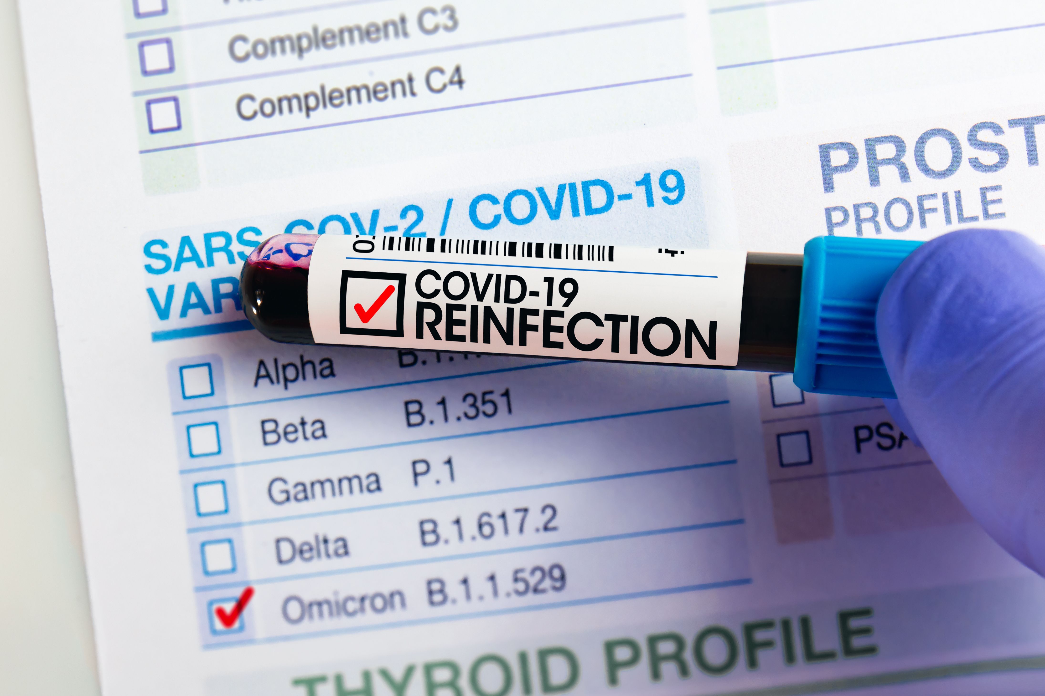 The Pathology Of COVID-19 Reinfection