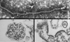 Nipah Virus Reappears 1 Year After Deadly Outbreak