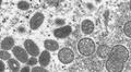 CDC, WHO Weigh in on Incidence Trends, Monkeypox Vaccines, Public Health Policies