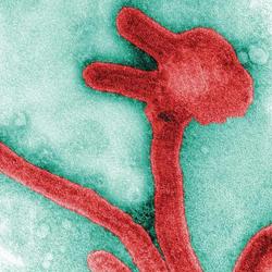 Marburg Virus Case Reported in West Africa