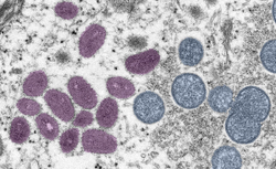 Can Wastewater Surveillance Predict Monkeypox Cases?