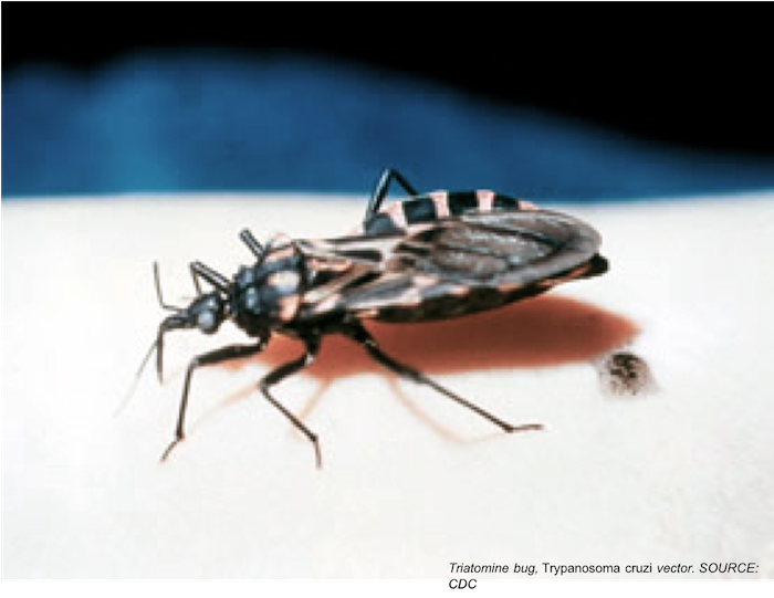 Details Of First Locally Acquired Case Of Chagas Disease In Missouri Details Of First Locally Acquired Case Of Chagas Disease In Missouri