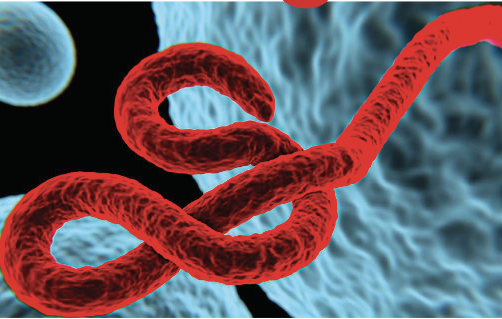post ebola syndrome