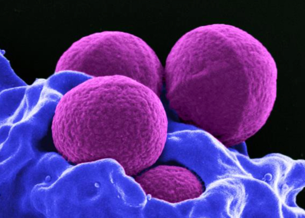 IDSA Addresses Critical Questions on Staph aureus Bacteremia