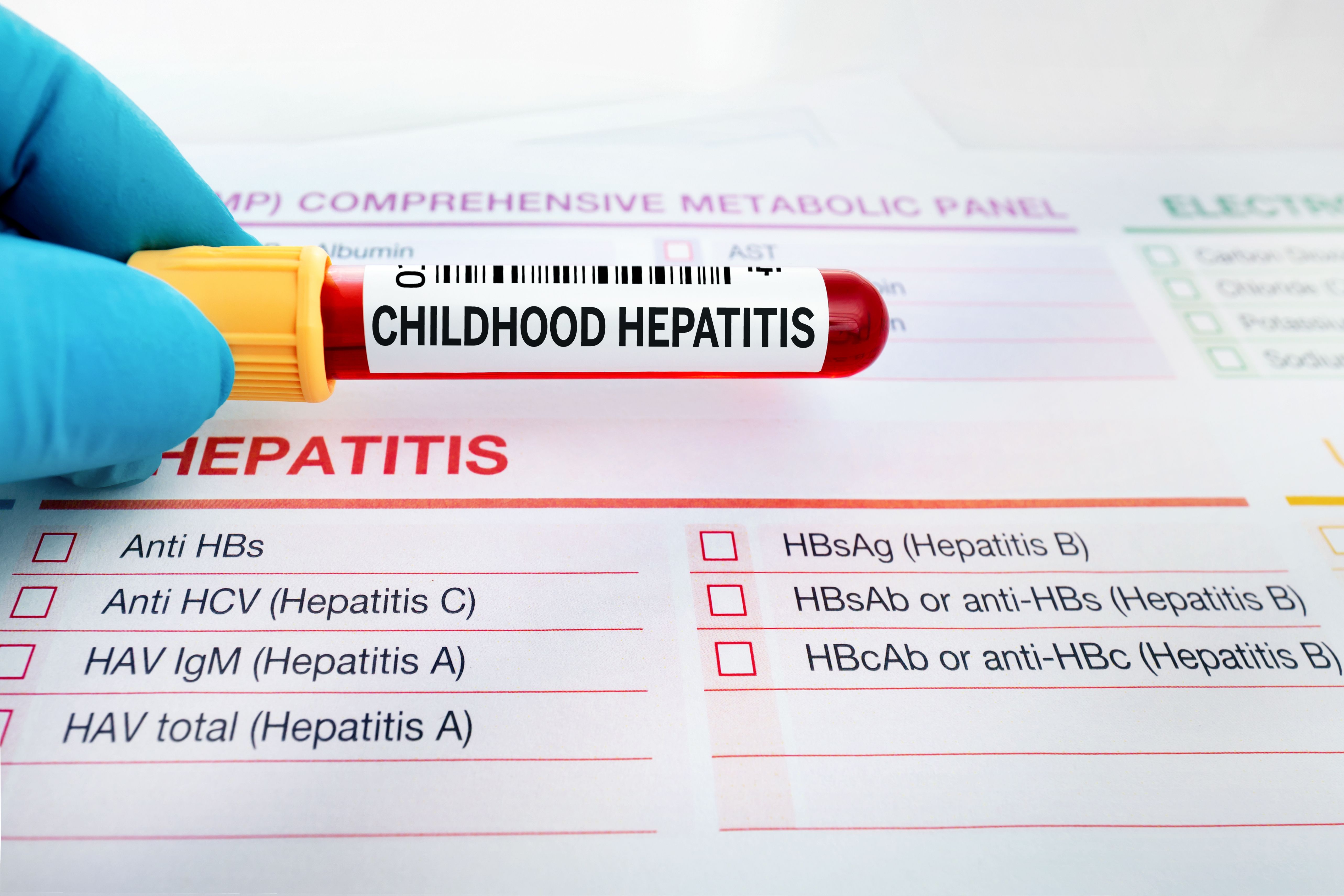 Adenovirus was determined to have caused most cases of hepatitis of unknown origin in children.