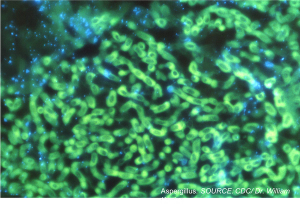 Exploring Primary Prophylaxis for Invasive Pulmonary Aspergillosis