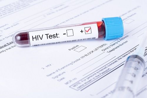 The study authors determined that patients with HIV were 38 percent more likely to die than those without HIV.