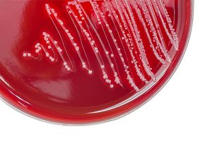 Strep Throat&mdash;To Fear or Not to Fear (Again)?