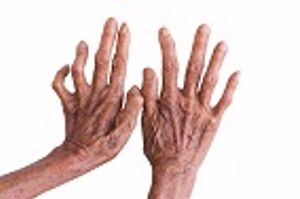 Aerosolized Transmission of Leprosy May Cause it to Persist