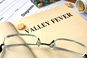 NIH Awards $4.8 Million to University to Fight Potentially Fatal Fungal Infection