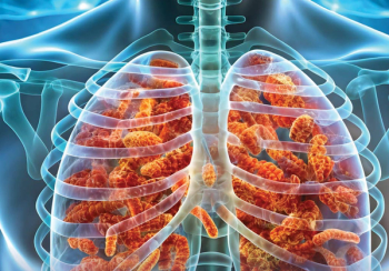New Diagnositics for Legionella Pneumonia May Streamline Care Continuum 