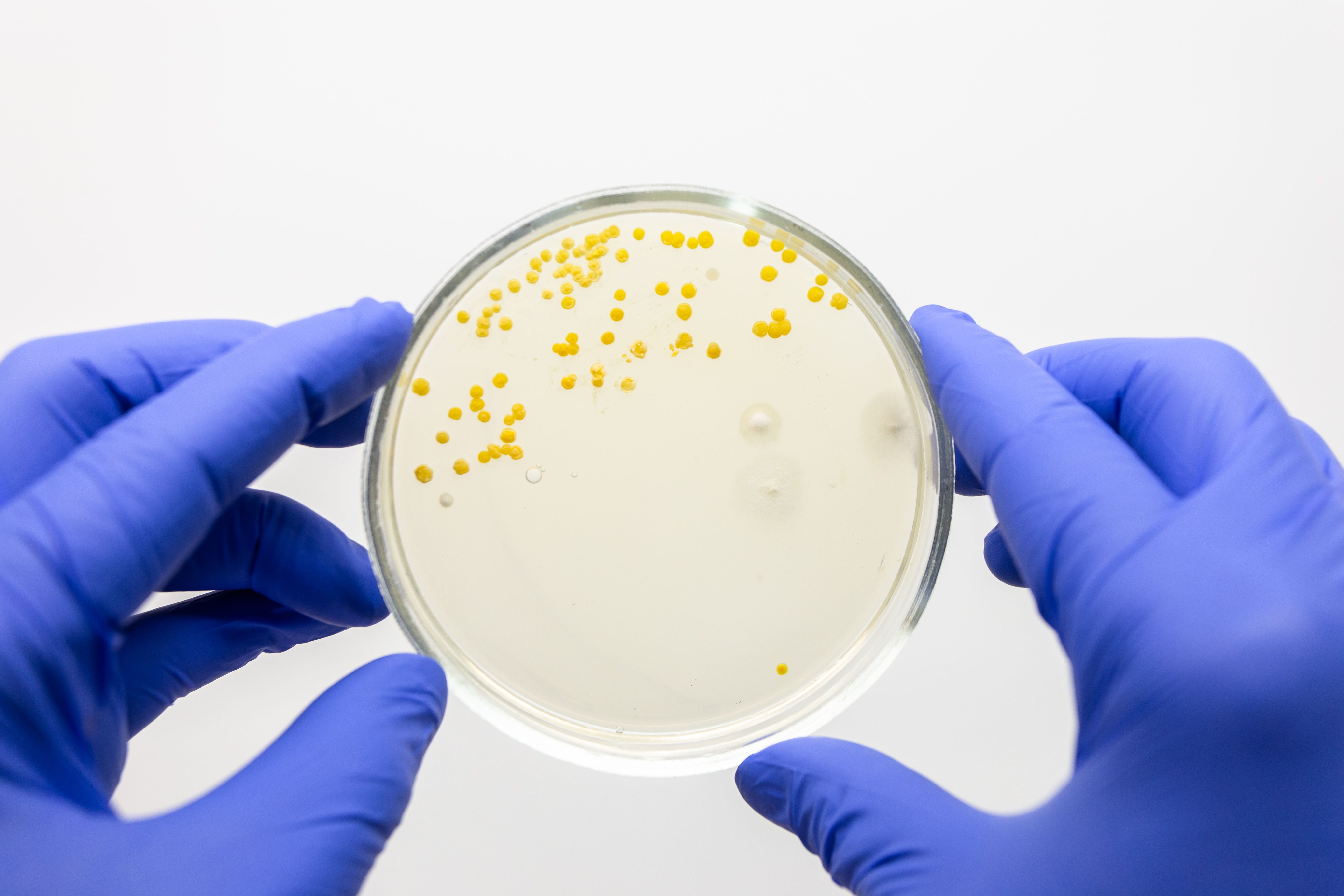 <![CDATA[SNAP Trial Favors Penicillin over 