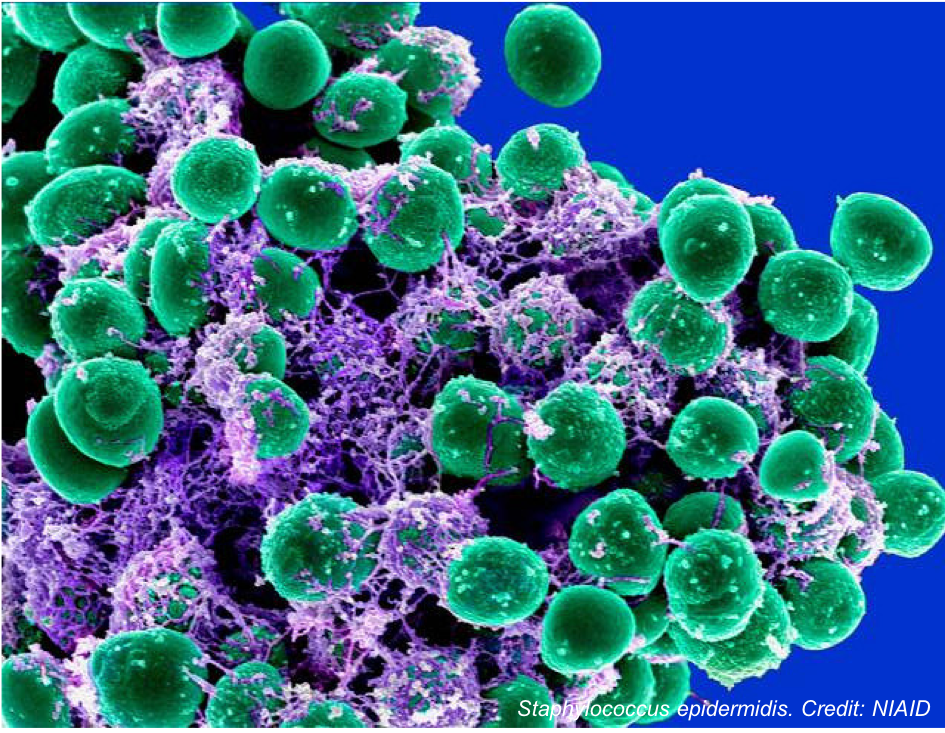 Are teicoplanin-non-susceptible Staphylococcus epidermidis strains  increasing?