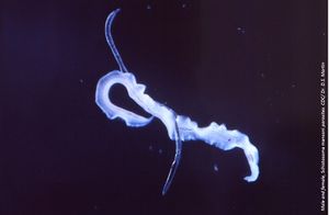 Schistosomiasis Linked With HIV Infection