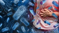 Invasive Nontyphoidal Salmonellosis:  An Antimicrobial-Resistant Foe