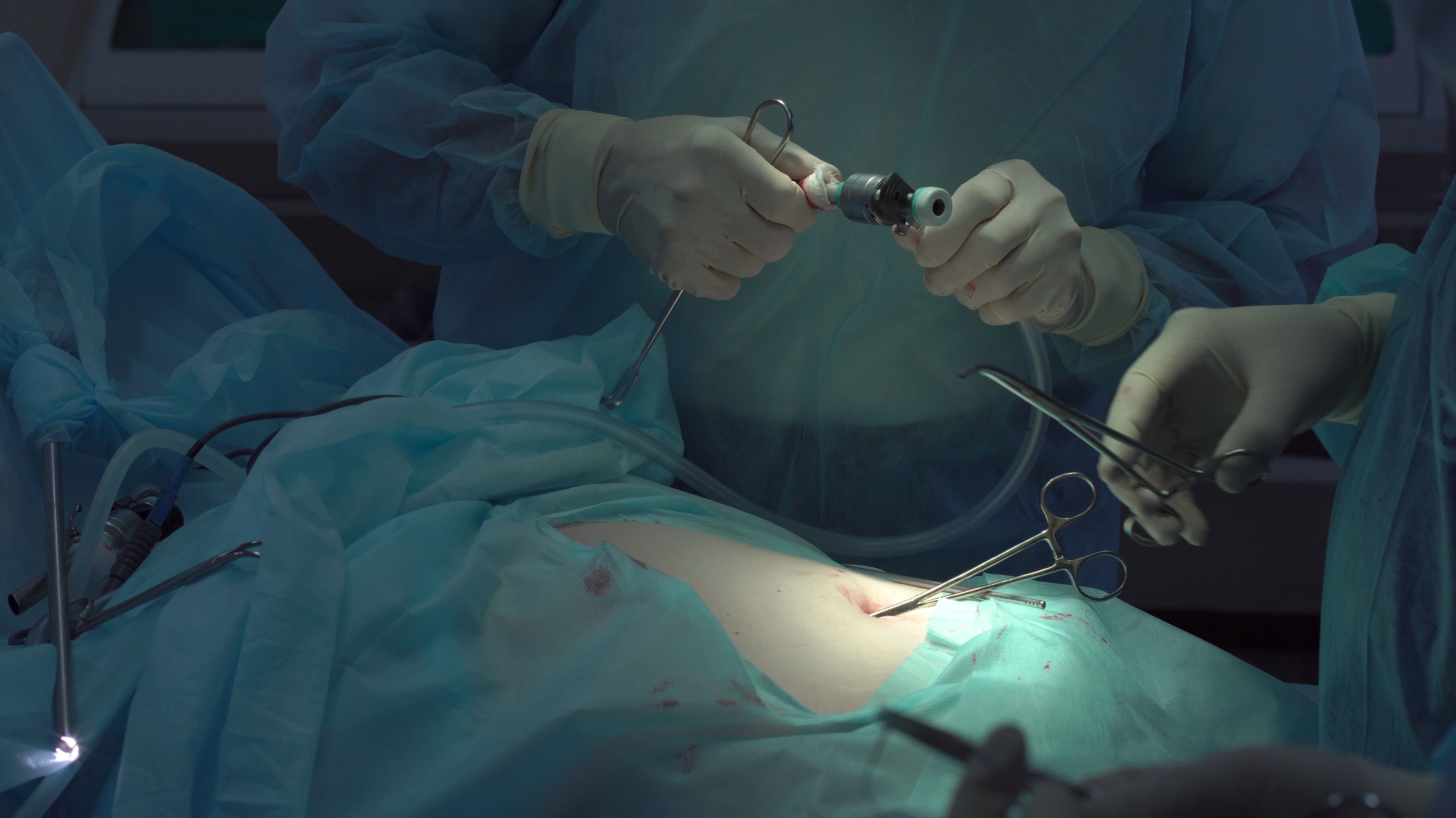 Which Of The Following Can Contribute To Postoperative Infections Can Breathing Exercises Reduce the Risk of Postoperative Infections