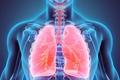 Reduced-Dose Trimethoprim-Sulfamethoxazole Effective in Treating Mild to Moderate Pneumocystis jirovecii Pneumonia