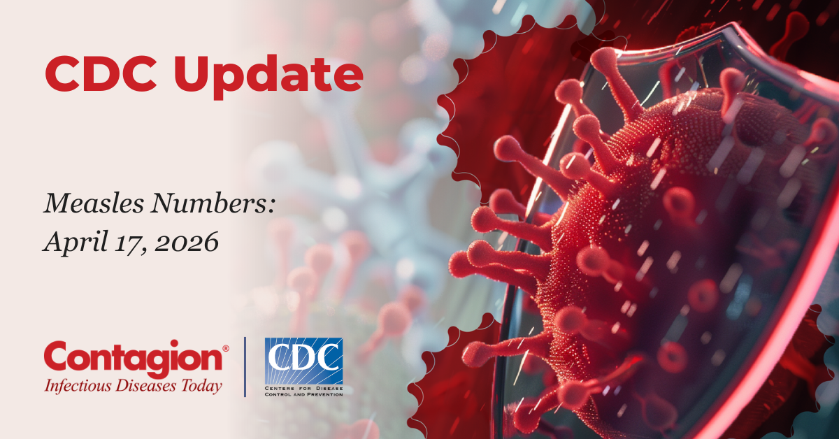 <![CDATA[Measles Update: April 17, 2026 ]]>