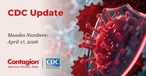 Measles Update: April 17, 2026 