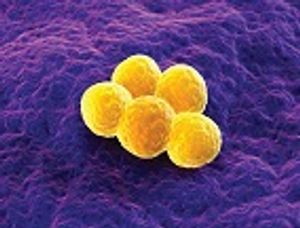 Gold Nanoparticle-Targeted Laser Therapy for Enhancement of Antibiotic Efficacy against MRSA Biofilms