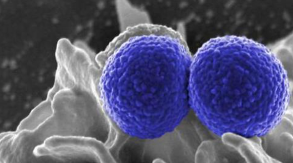 SNAP Global Trial Supports Cefazolin for MSSA Bacteremia