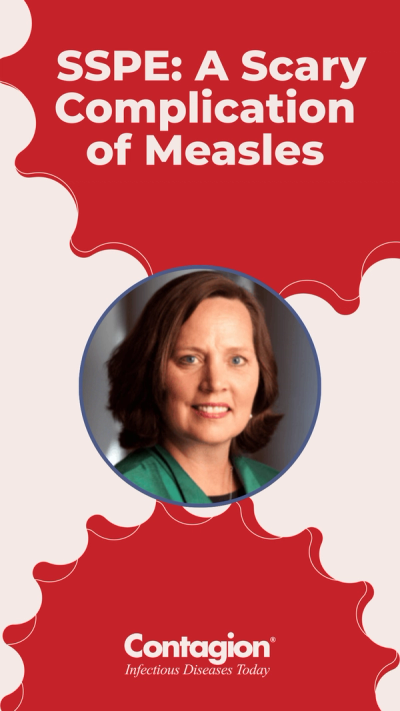 SSPE: A Scary Complication of Measles