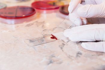 blood culture
