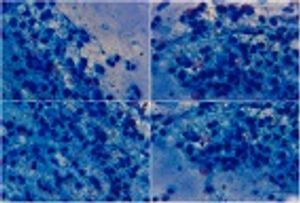 Researchers Develop New Antibiotics Effective Against Tuberculosis