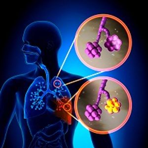 Changes in Therapy Recommendations in the 2019 ATS/IDSA Guidelines for Community-Acquired Pneumonia
