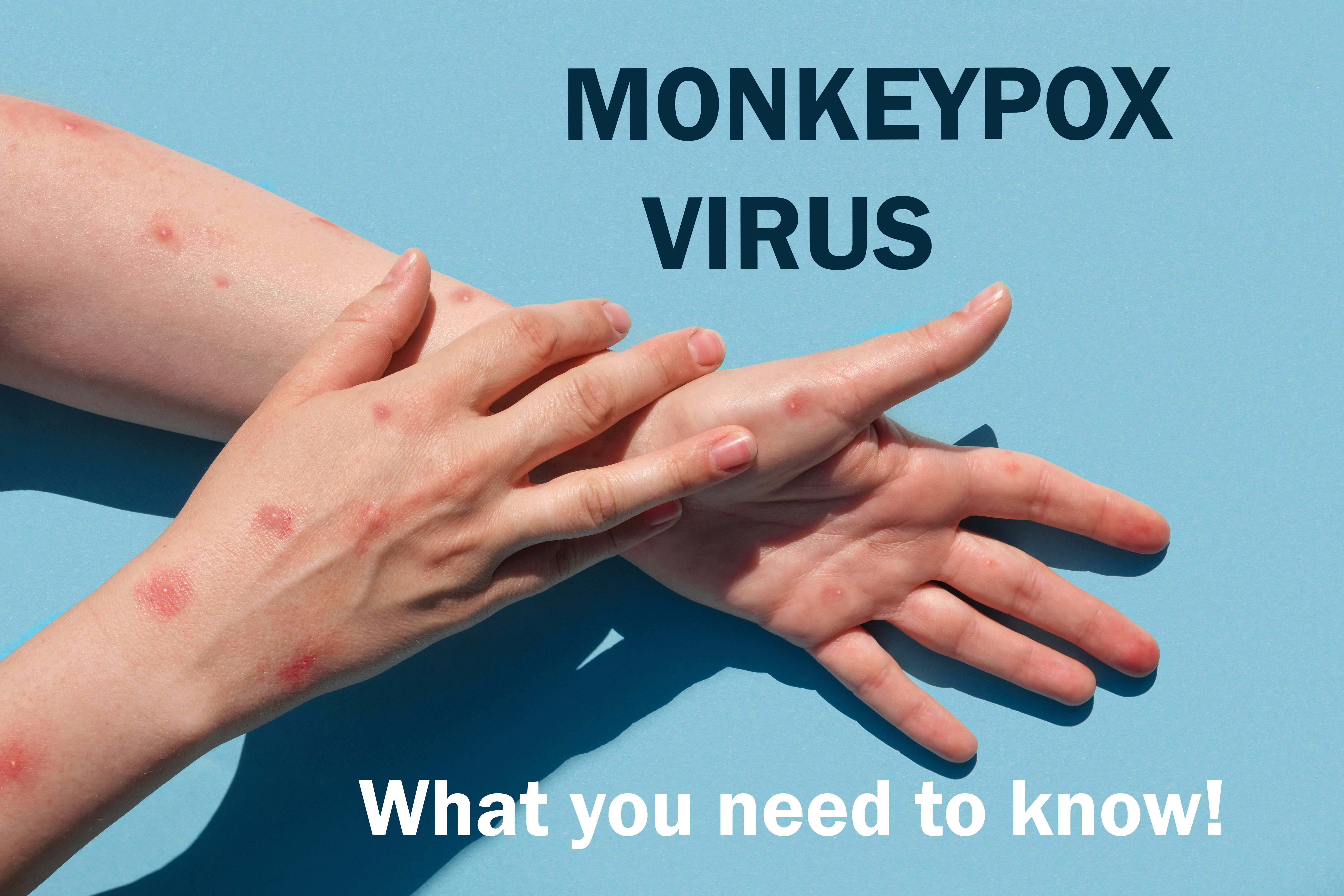 New precautions detail what clinicians treating suspected or confirmed monkeypox cases need to know.