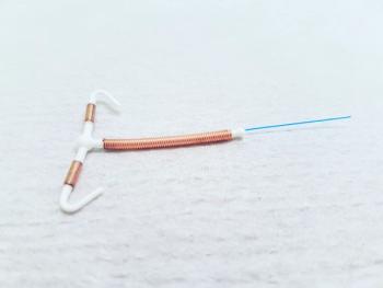 Copper IUD