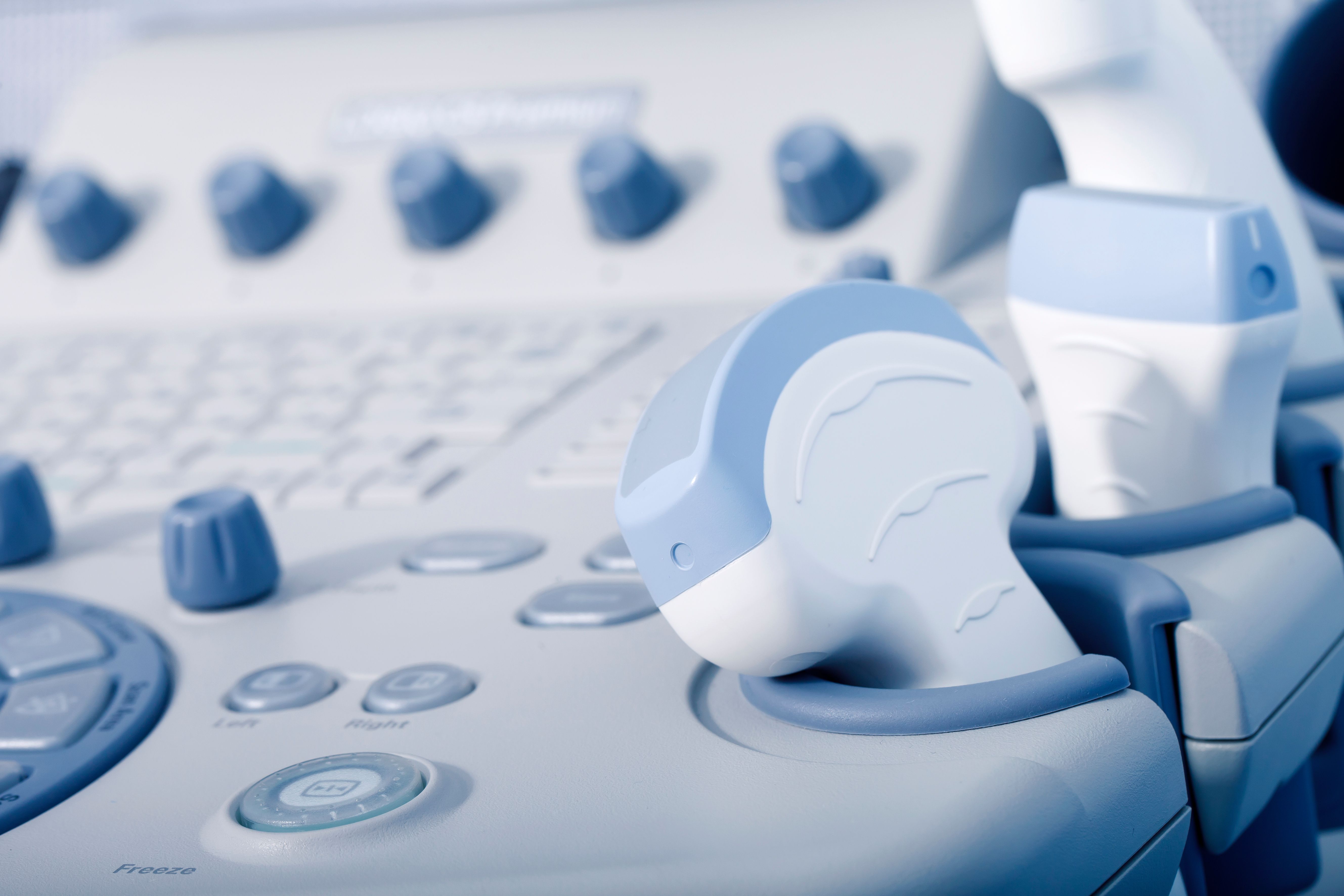 Early ultrasound linked to improved fetal anomaly detection | Image Credit: © homonstock - © homonstock - stock.adobe.com.
