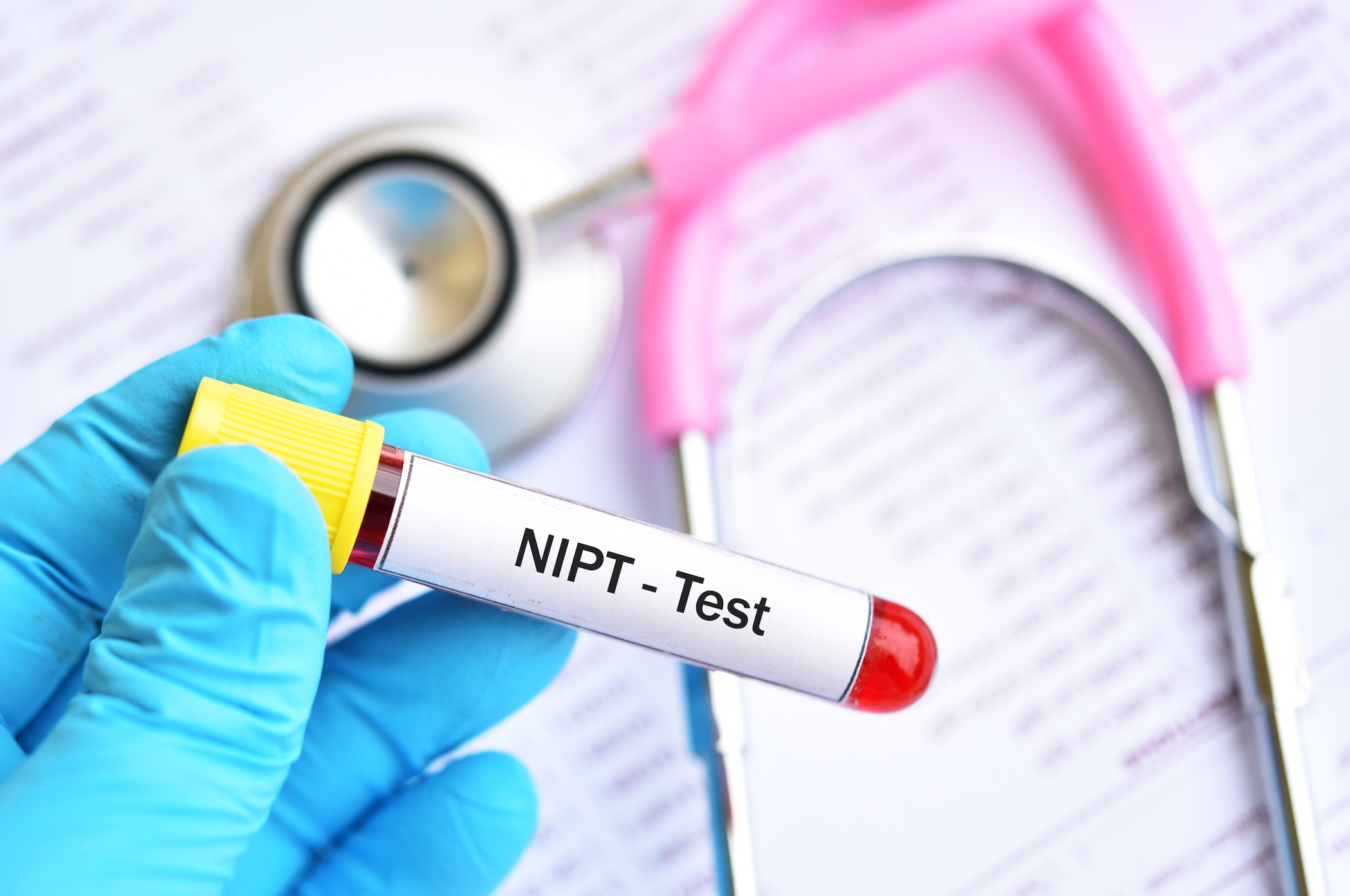 NIPT test