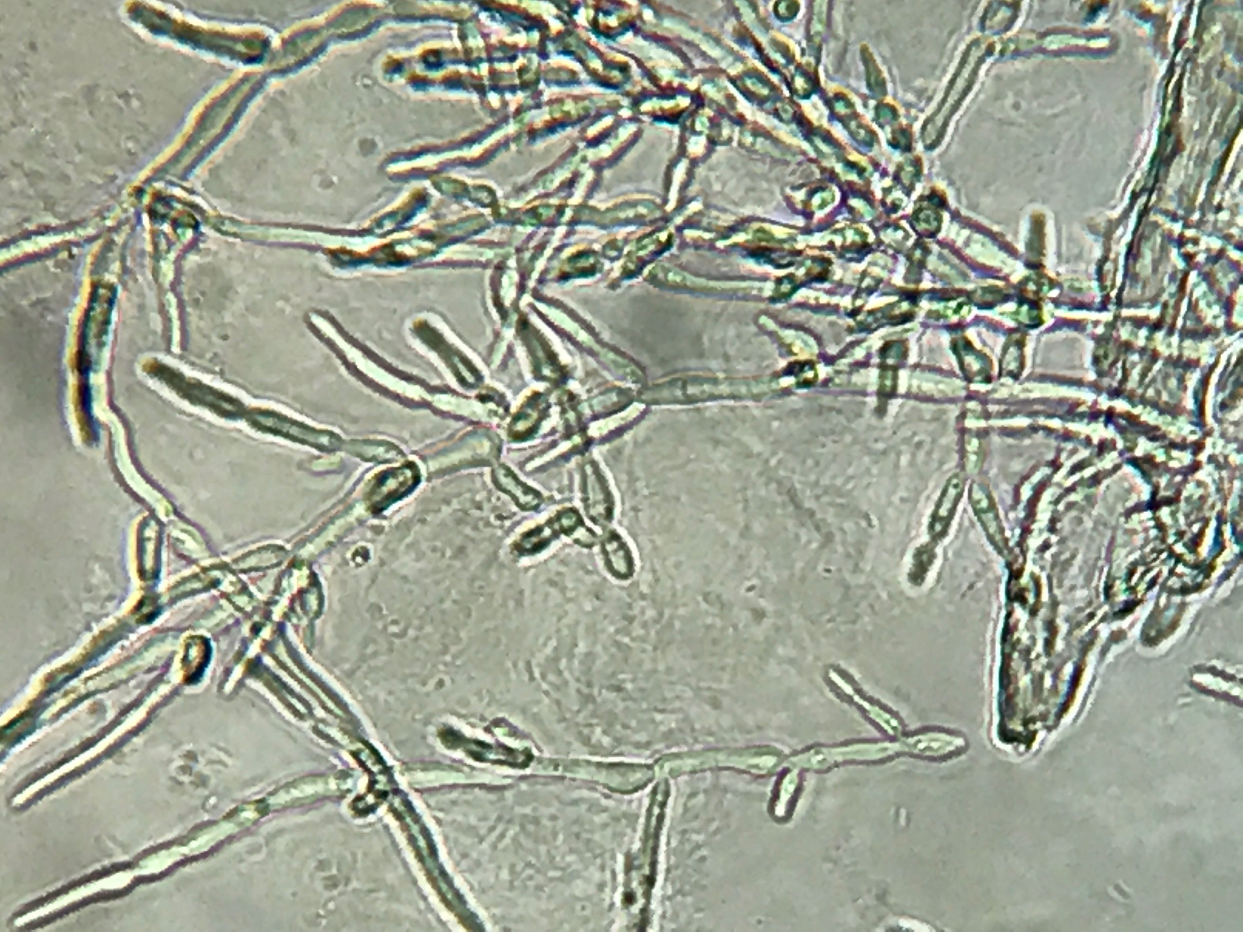 Cost Of Fluconazole 300 Mg