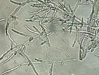 yeast