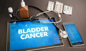 Bladder Cancer