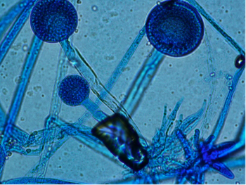 Rhizopus
