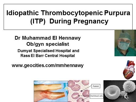 thrombocytopenic purpura