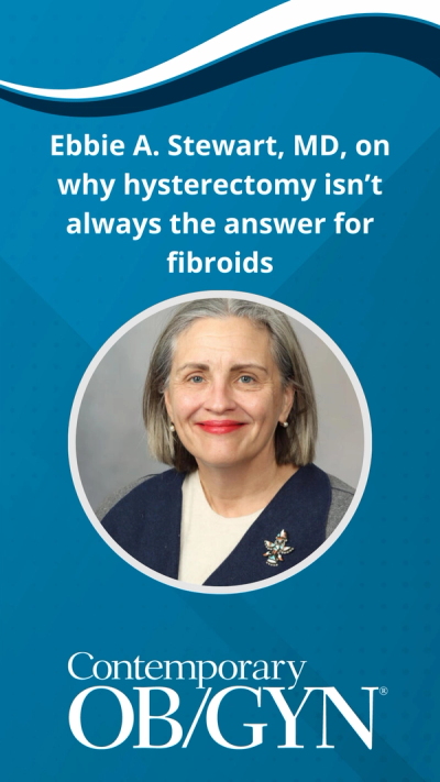 Ebbie A. Stewart, MD, on why hysterectomy isn’t always the answer for fibroids