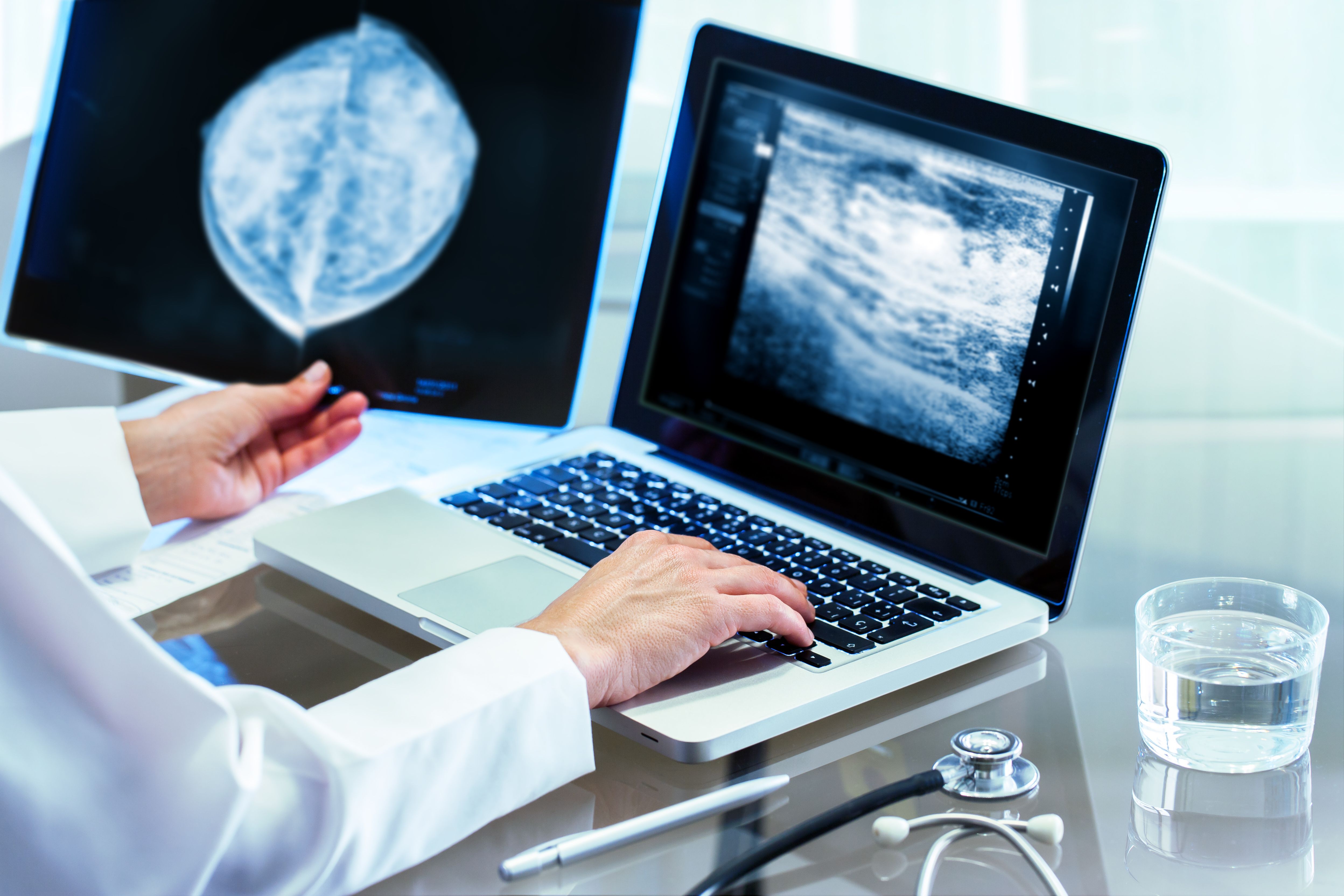 Patients show cautious support for AI in mammography screening Patients show cautious support for AI in mammography screening