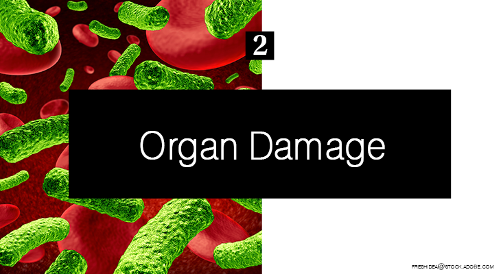 Organ damage