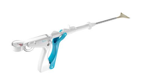 NovaSure V5 global endometrial ablation device