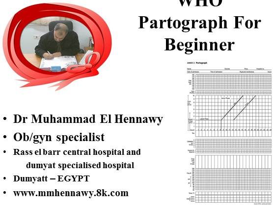 WHO Partograph for Beginner