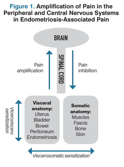 How to manage endometriosis-associated pain | Contemporary OB/GYN