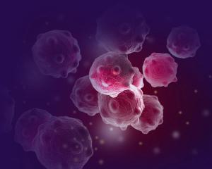 Dynamic treatment for early-stage triple-negative breast cancer